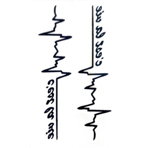 ការចាក់សាក់ ECG