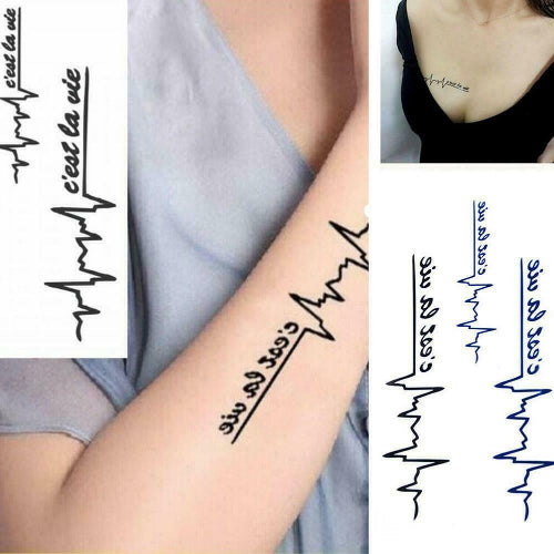 ការចាក់សាក់ ECG